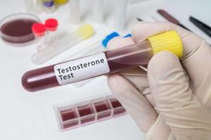 aad-testosteroni